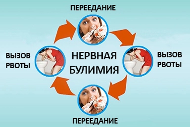 Лечение булимии в Нарышкино